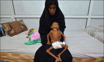 Moyen-Orient et Afrique du Nord: la malnutrition s'aggrave Moyen-Orient et Afrique du Nord: la malnutrition s'aggrave