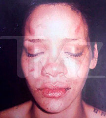 Photo de Rihanna Battue : Qui a diffusé la photo ?