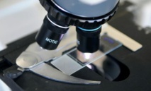 Sclérose en plaques: la piste de la réparation des neurones Sclérose en plaques: la piste de la réparation des neurones