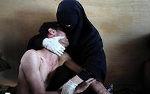 World Press Photo 2011: un Espagnol et trois photographes AFP récompensés World Press Photo 2011: un Espagnol et trois photographes AFP récompensés