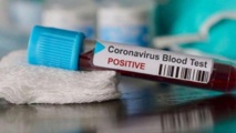 Le nombre de cas confirmés de COVID-19 en Afrique dépasse la barre des 1,3 million,affirme le CDC Afrique