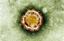 Coronavirus MERS: un 56e décès en Arabie saoudite Coronavirus MERS: un 56e décès en Arabie saoudite