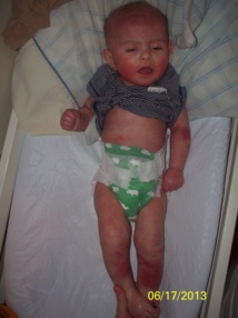 Cette mère pense devoir mettre fin à la vie de son enfant tellement il souffre Cette mère pense devoir mettre fin à la vie de son enfant tellement il souffre