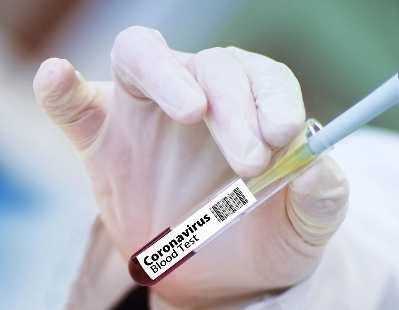 Coronavirus : 31 décès et 511 cas confirmés en Algérie