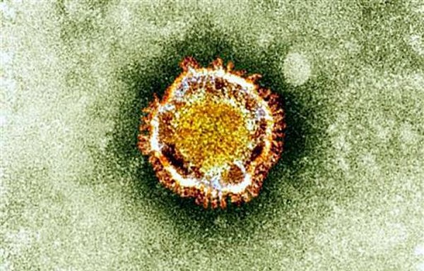 Coronavirus MERS: un 56e décès en Arabie saoudite