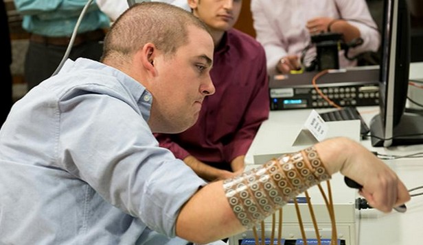 Un tétraplégique parvient à utiliser sa main grâce à un logiciel, une première