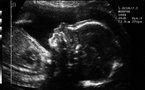 Les bébés présents sur le web de plus en plus tôt, même avant leur naissance