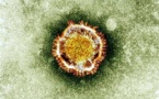 Coronavirus MERS: un 56e décès en Arabie saoudite